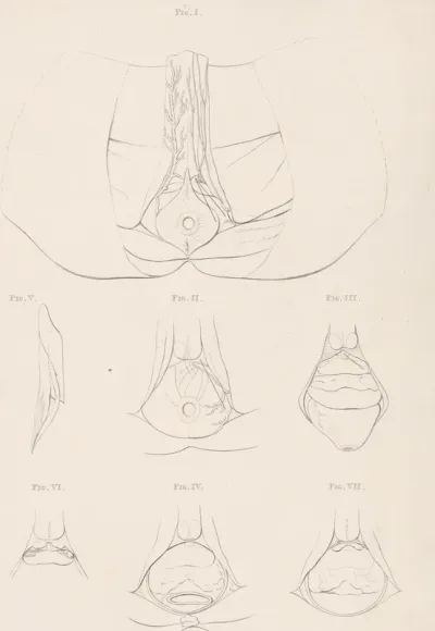 Anatomische afbeelding van de pelvis