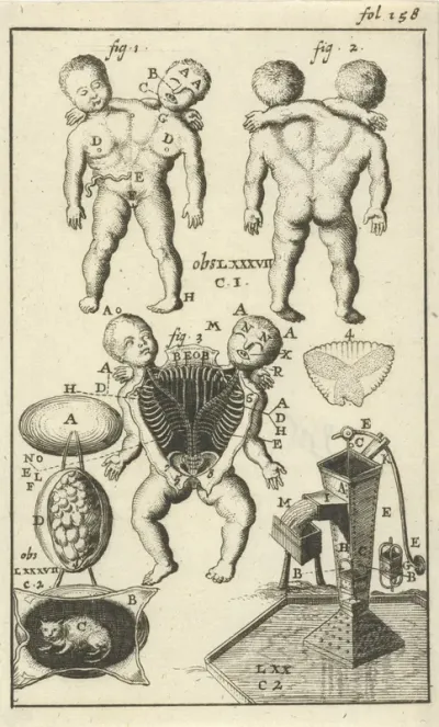 Anatomische afbeelding VI