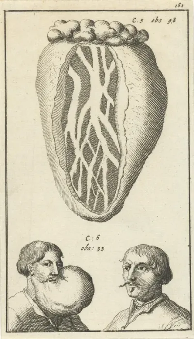 Anatomische afbeelding XIV