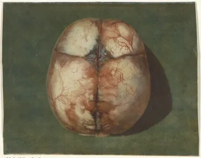 Anatomische studie van de schedel van een onvoldragen kindje