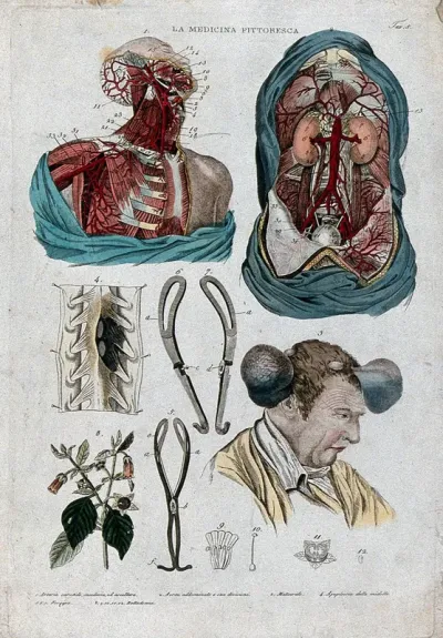 Anatomy and botany; top left, dissected head and chest; top right, dissected thorax; centre left, forceps; centre right, man with tumours on his head; bottom left, belladona plant
