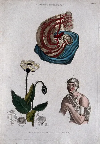 Anatomy, nursing and botany; top, arteries of the breast; bottom left, poppy; bottom right, man with bandaged head and arm