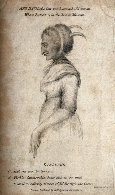 Ann Davis, a woman with smallpox and horns growing out of her head