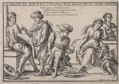 Arabian doctors perform bleeding on poor Italian people; money jets out with the blood; signifying learned Arabs fleecing the poor
