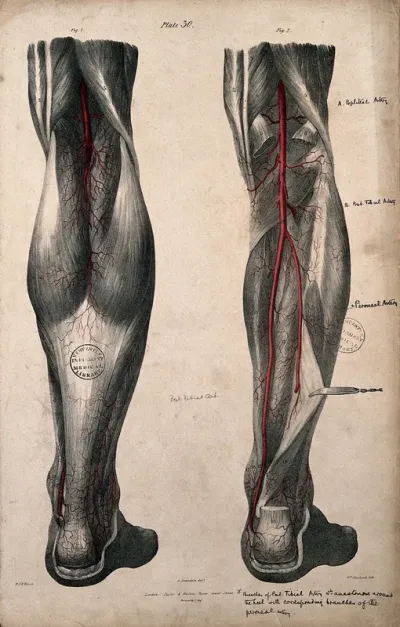 Arteries of the leg