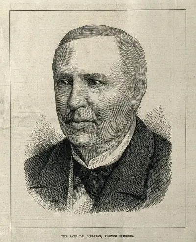 Auguste Nélaton