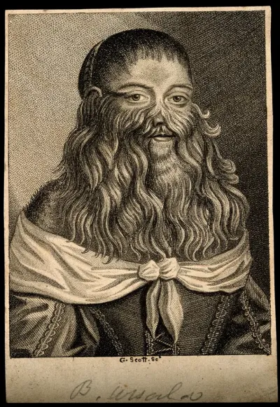 Barbara van Beck, a hirsute woman