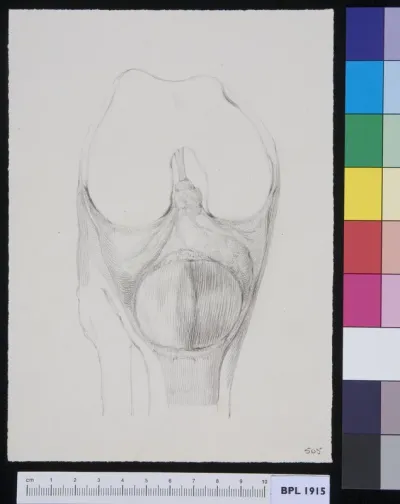 Bone from the leg