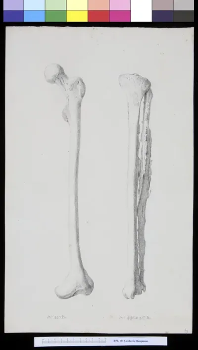 Bone of the leg (femur, tibia and fibula)