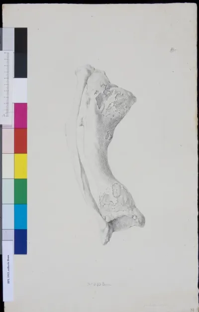 Bone of the lower leg (tibia and fibula)