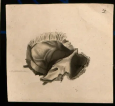 Bone of the skull