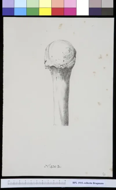 Bone of the upper arm (humerus)