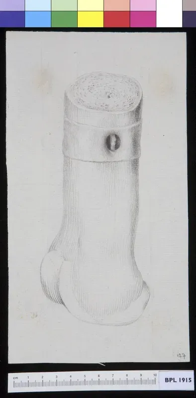 Bone
