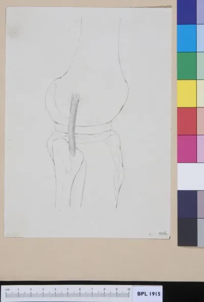 Bones from the leg, patella?