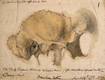 Bones of the cheek: side view of the temporal, schenoid and malar bones