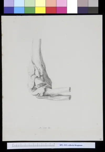 Bones of the elbow