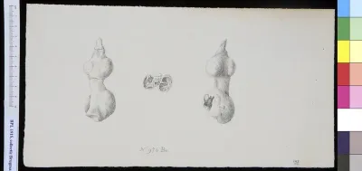 Bones of the hand (phalanx bones)