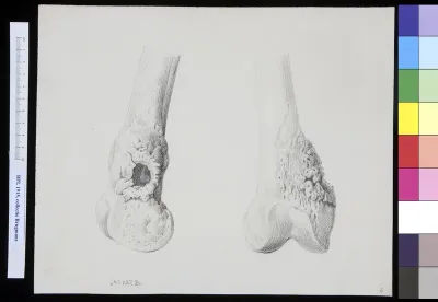 Bones of the leg (tibia?)