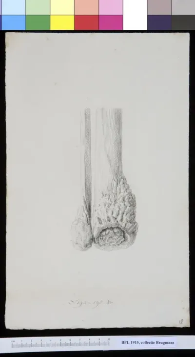 Bones of the lower leg (fubula and tibia)