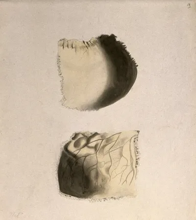 Bones of the skull: two figures