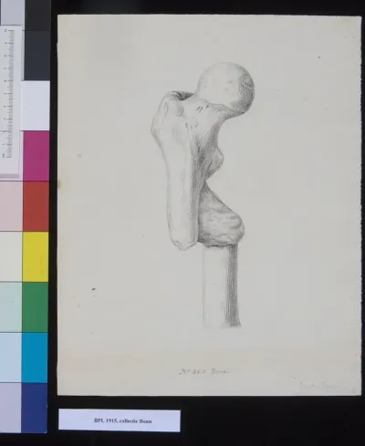 Bones of the upper leg (femur)