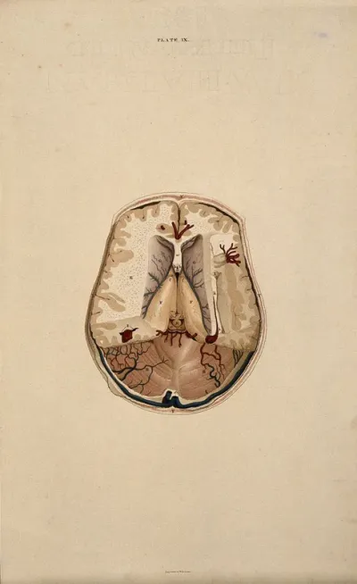 Brain: dissection showing a horizontal section
