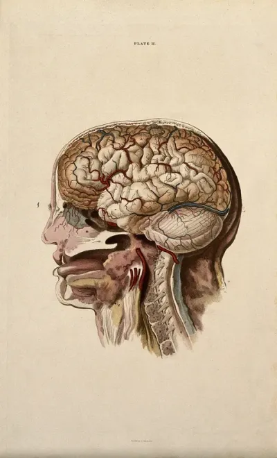 Brain: dissection showing cross-section through head and neck, with lateral view of the brain