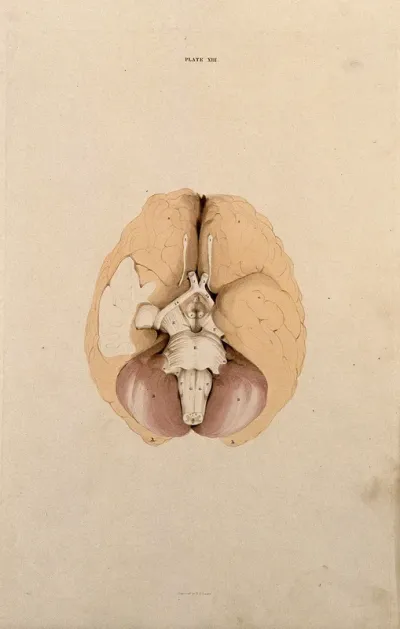 Brain: dissection showing the base of the brain