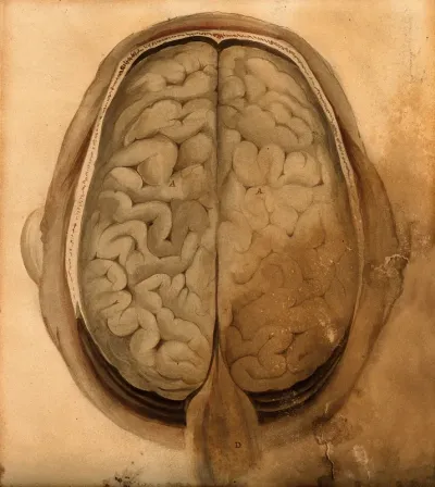 Brain: dissection showing the gyri, seen from above