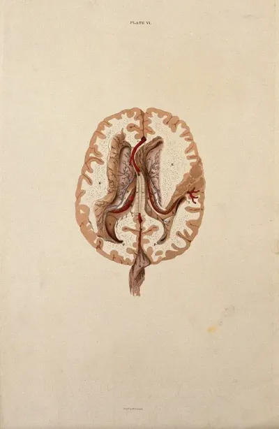 Brain: horizontal section showing lateral ventricles
