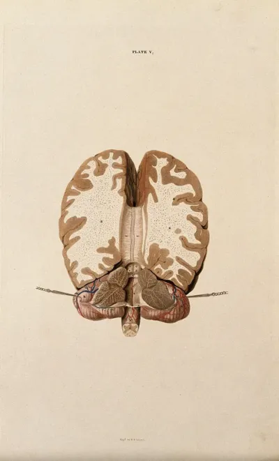 Brain: horizontal section
