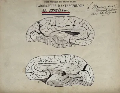 Brain sections. Drawing by Léonce Manouvrier, ca. 1900