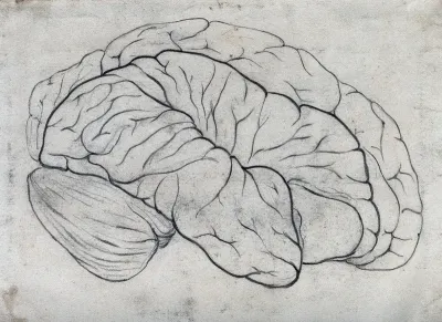 Brain with defect in the right frontal region