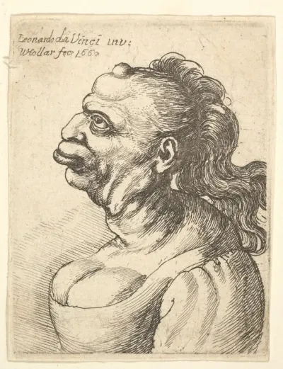Bust of a woman wearing low-cut dress, with protruding lipd, growth on her forehead, prominent breast, long flowing hair down her back, in profile to left.