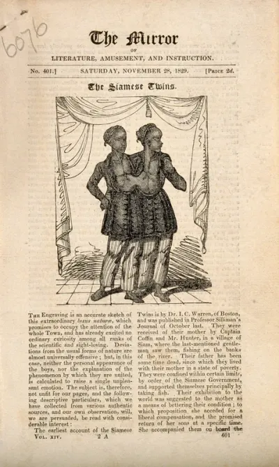 Chang and Eng, the Siamese twins