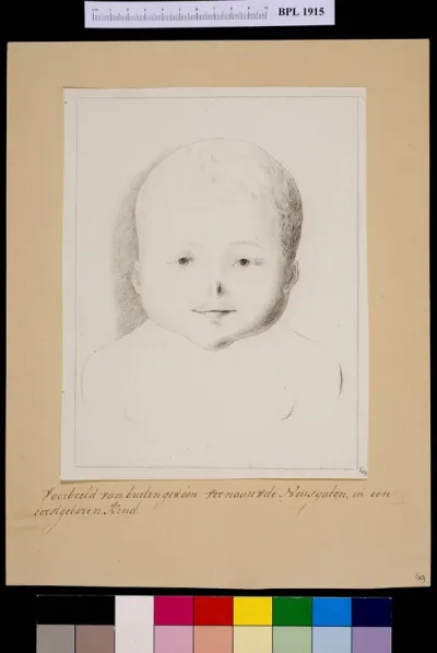 Child's head with narrowed nose