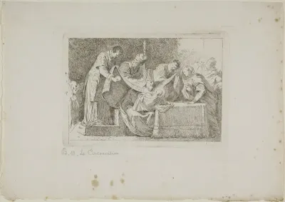 Circumcision