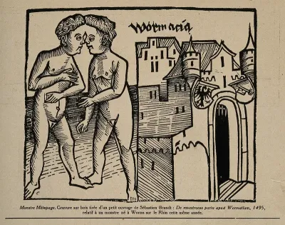 Conjoint twins, joined at the head, born at Worms in 1495