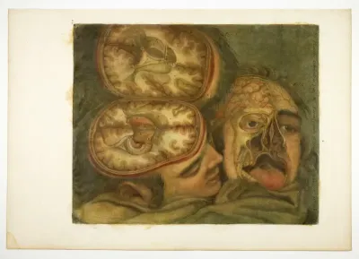 Cranial Dissection, plate five from Anatomy of the Head, in Printed Paintings