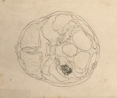 Cross-section of a skull including detail of inner ear