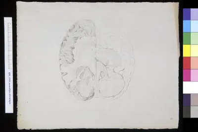 Cross section of the brain