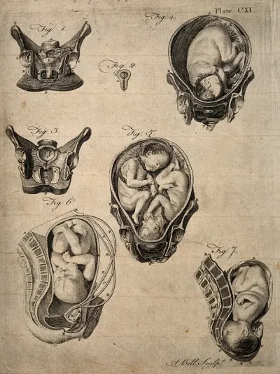 Cross-sections of seven different figures of the pregnant uterus