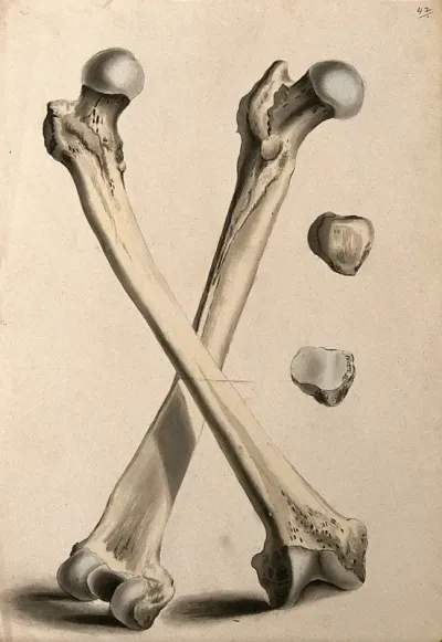 Crossed femurs (thigh-bones)