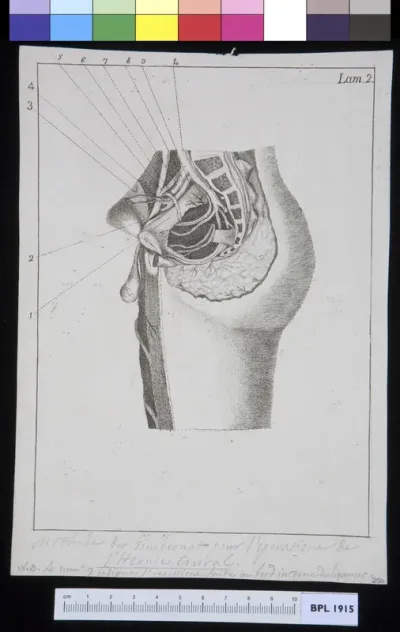Crural arch (inguinal canal) according to Antonio Gimbernat