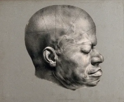 Death mask of Eustache, a slave from the Dominican republic who came to be awarded a 'prize for virtue' in 1830's Paris