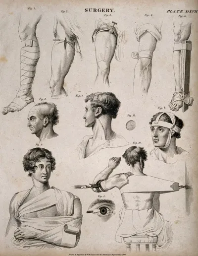 Diagrams illustrating: five bandaged legs (three with different sorts of splints), two heads showing veins, a bandaged head, a bandaged torso, a recepticle with body for curing shoulder dislocations and an eye operation