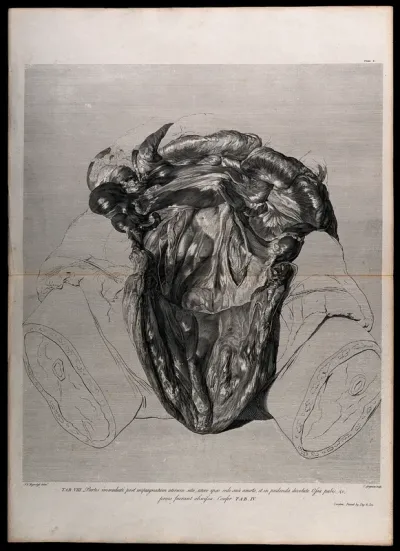Dissection made after the removal of a pregnant uterus, showing the parts lying immediately behind