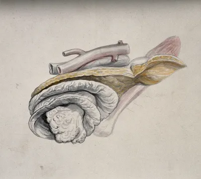 Dissection of an internal organ