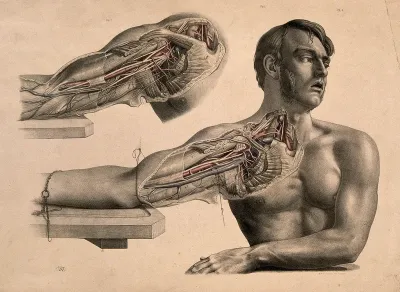 Dissection of muscles and blood-vessels of the shoulder and arm of a seated man