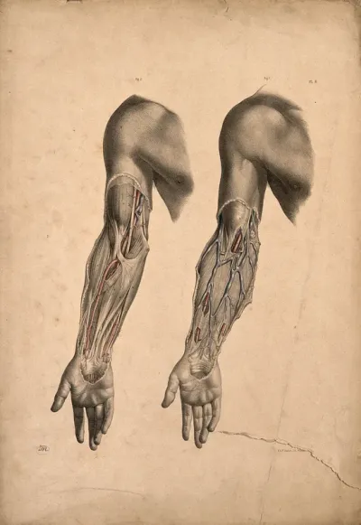 Dissection of muscles and blood-vessels of the upper arm: two figures